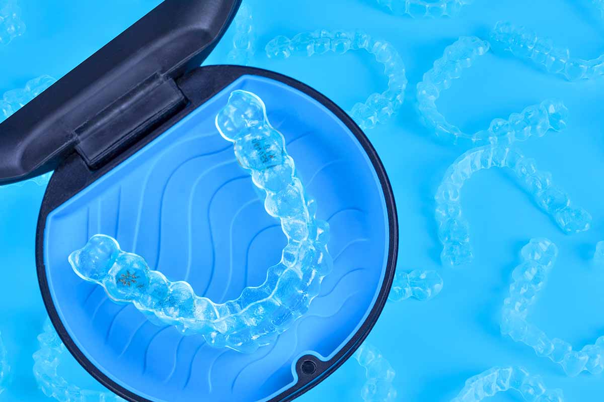 Invisalign-7
